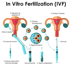 IVF Success Rates