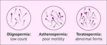 Treatment of Teratospermia