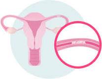 Yoga to Unblock Fallopian Tubes