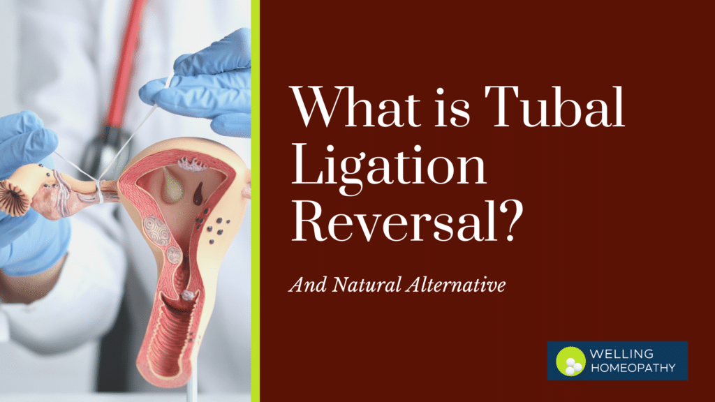 Tubal Recanalization