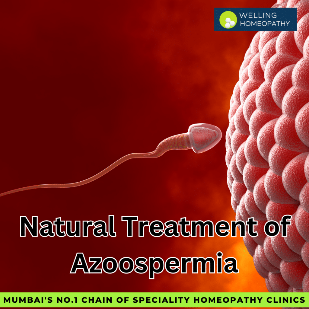 Natural Treatment of Azoospermia