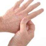 Homeopathy Treatment of Rheumatoid Arthritis