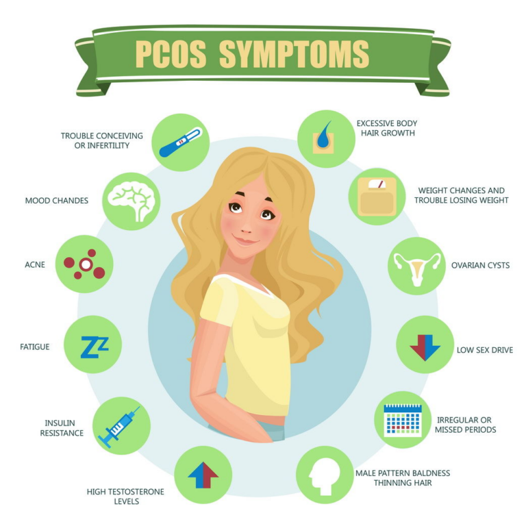 How To Cure PCOS Permanently