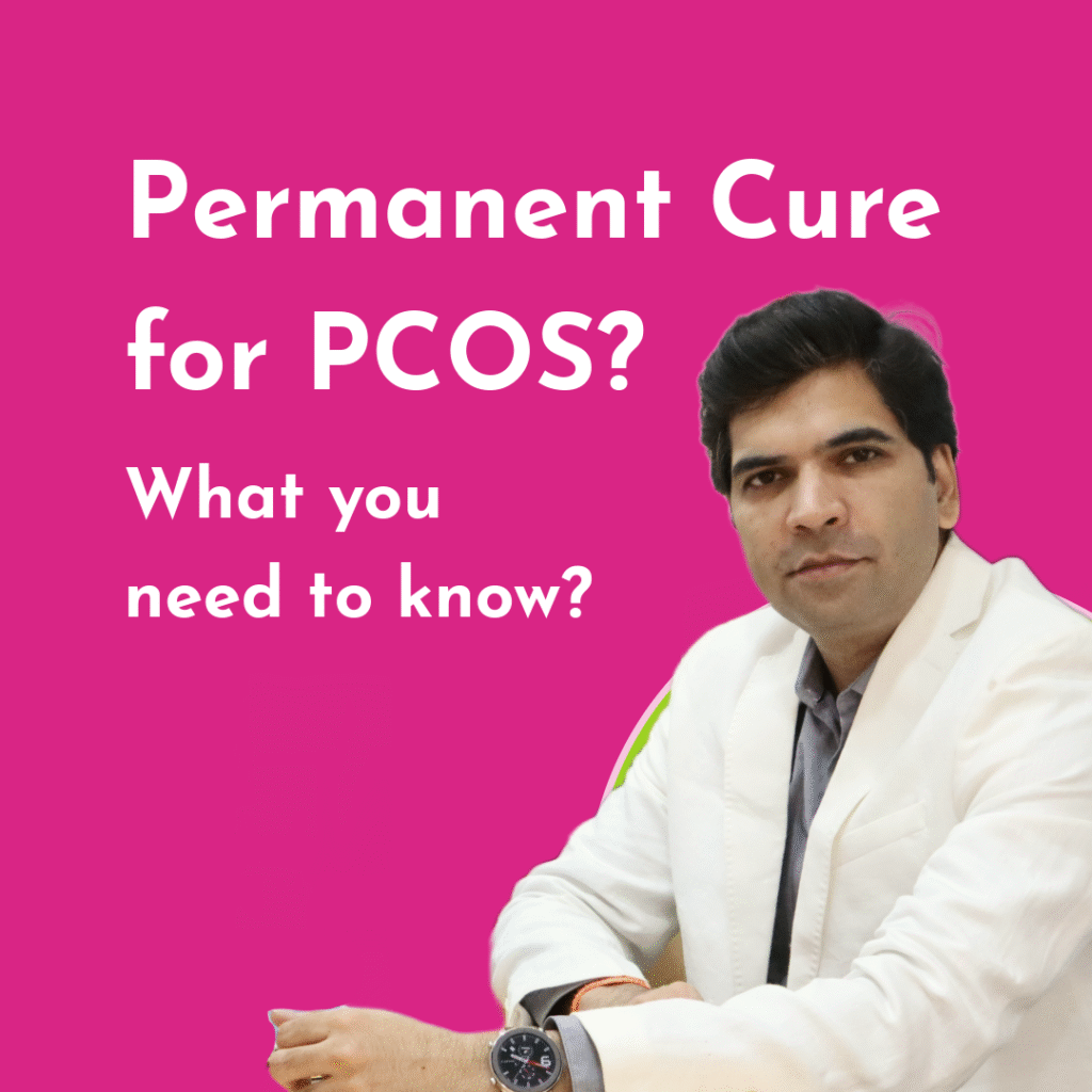 How To Cure PCOS Permanently